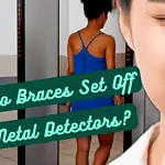 do braces set off metal detectors